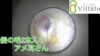 耳掃除動画vol.65「髪の毛2本入り アメ耳さん」