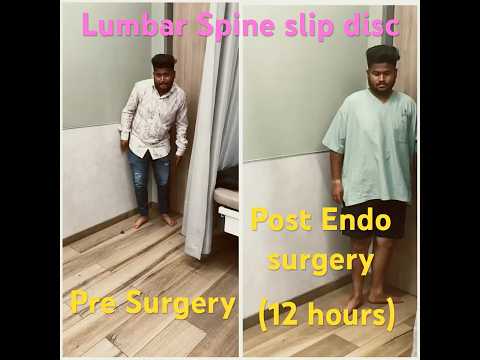 Robotic Spine surgery