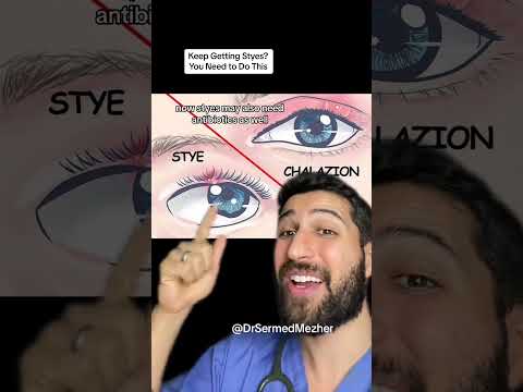 Stop Getting Styes by Doing This #eyelid