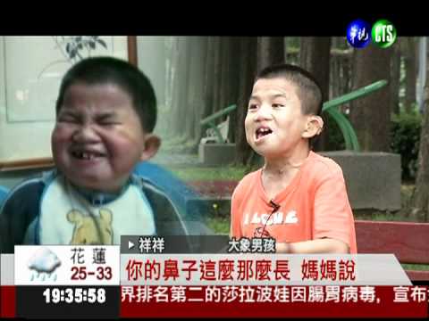 生命鬥士! 身心障礙者扭轉命運