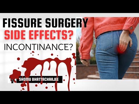 Laser surgery for piles fissure and fistula Laser treatment for piles fissure and fistula benefit