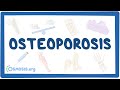 Osteoporosis - causes, symptoms, diagnosis, treatment, pathology