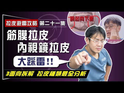 【拉皮避雷攻略|第二十一集】筋膜拉皮、內視鏡拉皮效果差不持久? 3大面向拆解各種拉皮手術 拉皮不踩雷就要這樣選!