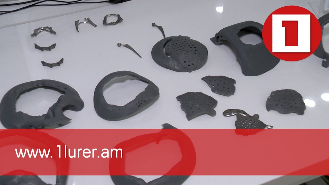 Նորագույն տիտանե  իմպլանտներ՝ ոսկրային վնասվածքով զինծառայողների համար