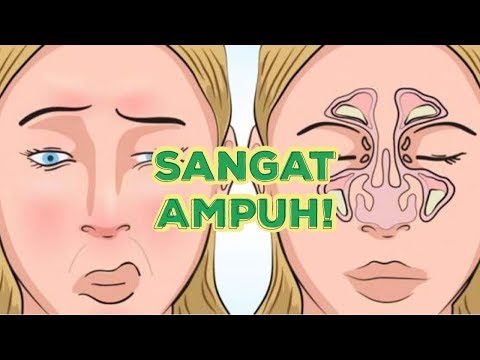 download lagu mp3 mp4 Tips Mengatasi Hidung Tersumbat, download lagu Tips Mengatasi Hidung Tersumbat gratis, unduh video klip Tips Mengatasi Hidung Tersumbat