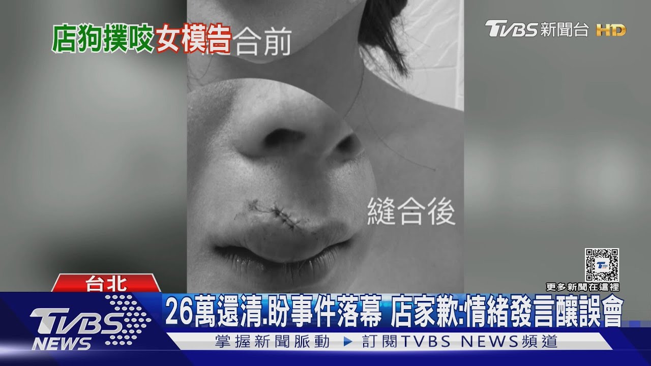 遭「狗咬唇」反被投訴　女模控：店家消極才提告