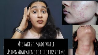 My Adapalene mistakes| Using too much product | Irritation,redness,dry skin| Khushi Mahla