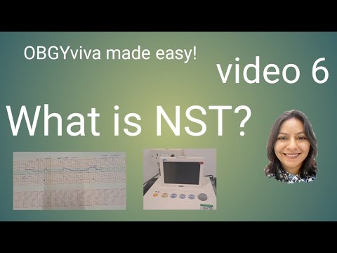 Was ist NST? obgy Viva leicht gemacht! Video 6 @medicitchat