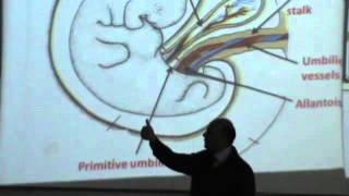 19) Dr.Sherif 26/03/2014 [Umbilical Chord]