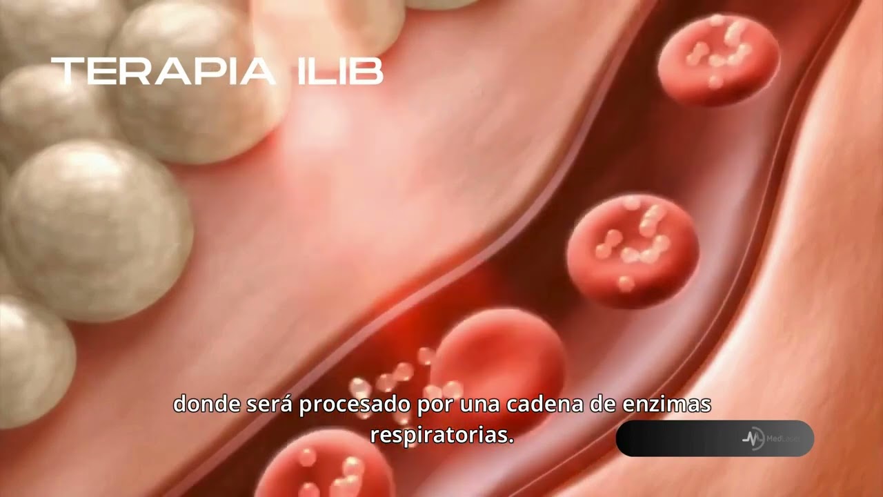 Terapia ILIB con láser diodo ✨ | Beneficios para tu salud y bienestar