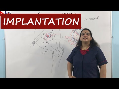 Implantation | Placenta development | Nursing lecture