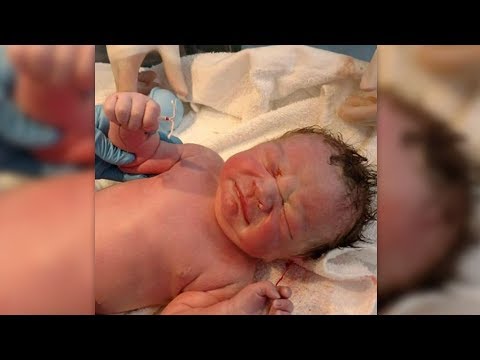 Was ist atopitscheski die Hautentzündung nejrodermit Awizenna die Schuppenflechte die Behandlung