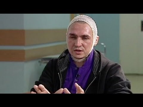 Filin says 'wait and see' for acid attacker