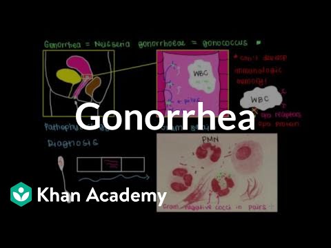 hogy a gonorrhoea hogyan befolyásolja a látást