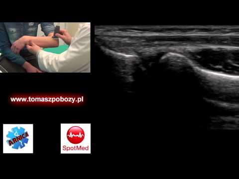 Skurcz mięśni 5 liter I pompowana do najszerszego grzbietu