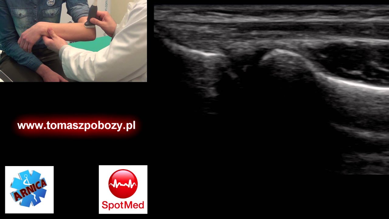 USG łokcia — badanie ortopedyczne