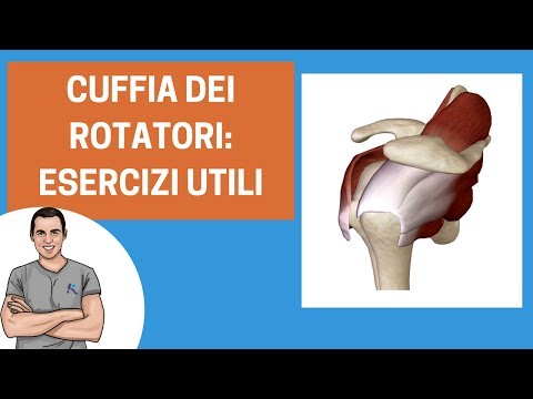 Rinvio di osteocondrosi Una pasta utilizzata nella dislocazione dellarticolazione della spalla