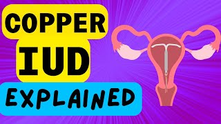 COPPER IUD EXPLAINED - INTRAUTERINE DEVICE - WHAT IS IT AND HOW IT WORKS!