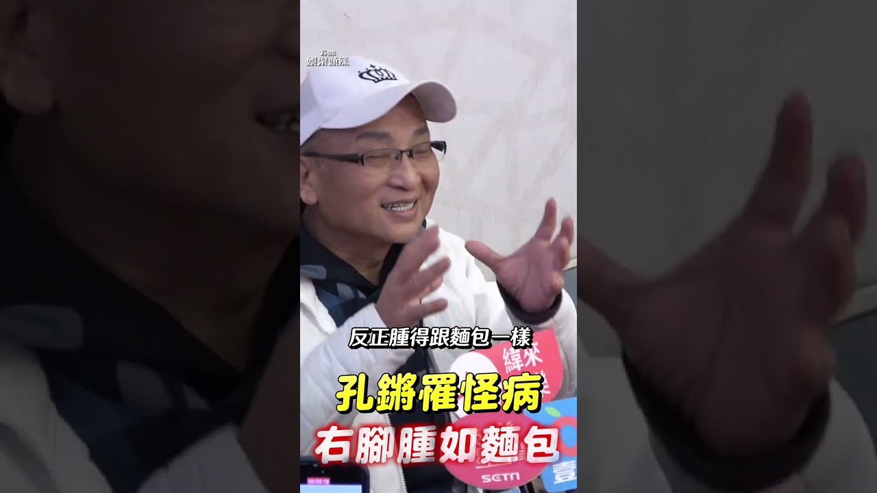 66歲孔鏘腳浮腫「好怕截肢」!3怪病纏身突發作 查不出病因