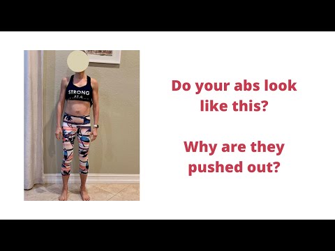 Do your abs look like this? Why are they pushed forward?