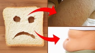 10 Warning Signs of Gluten Intolerance Everyone Ignores!