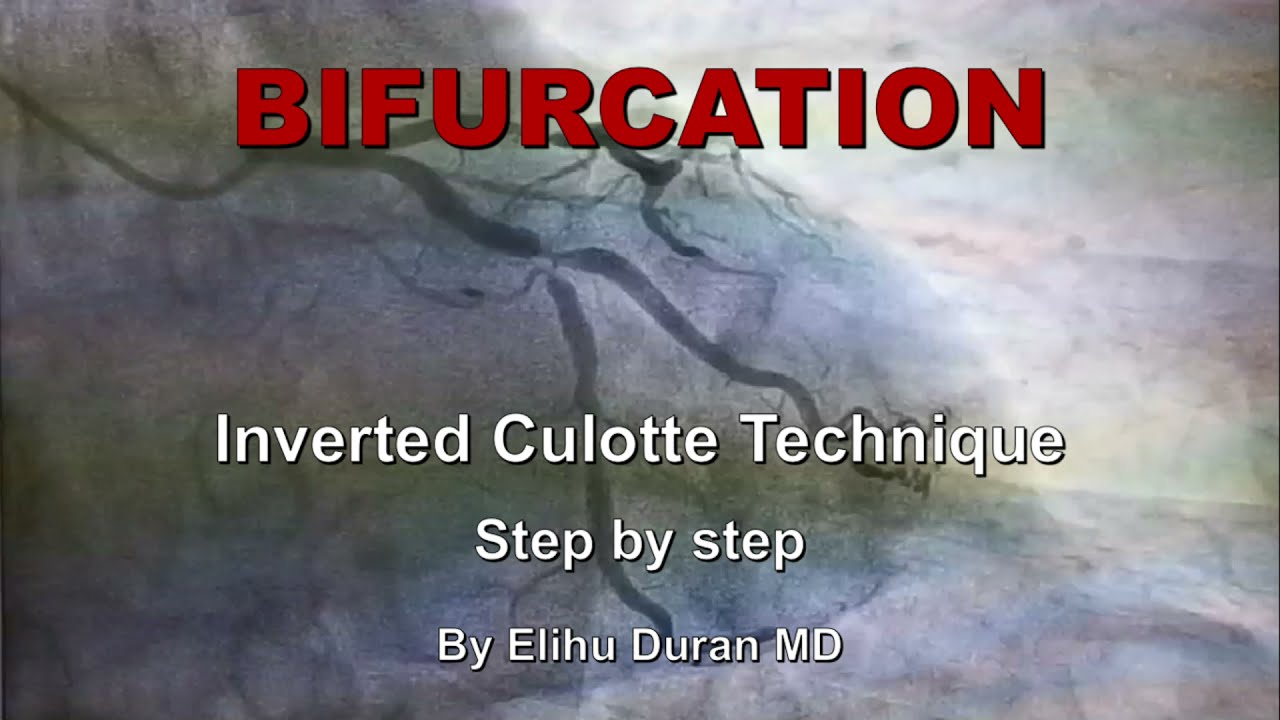 Elihu Durán Cortés-43