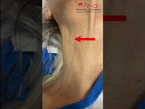 Arterial Pulse Vs. Venous Pulse