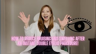 How to reduce bruising and swelling after an instant double eyelid procedure!