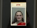 People before and after addiction #shorts