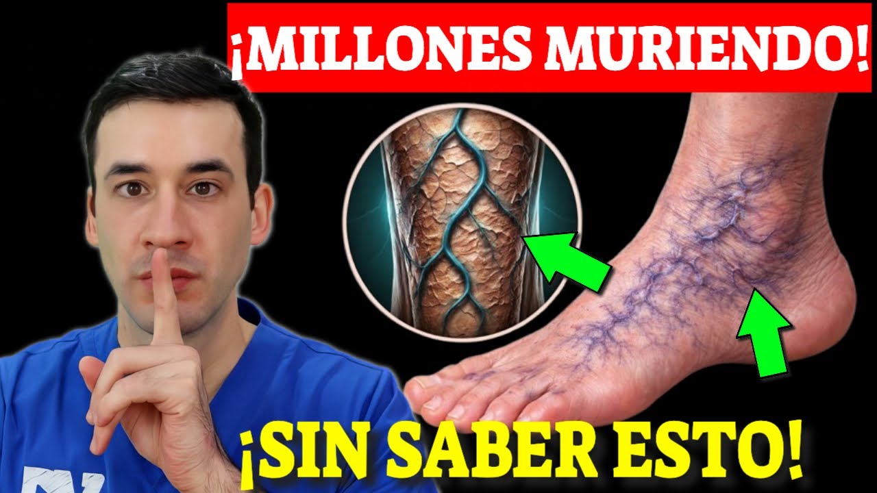 ¡MILLONES MORIRÁN con VÁRICES! POR NO SABER ESTO!