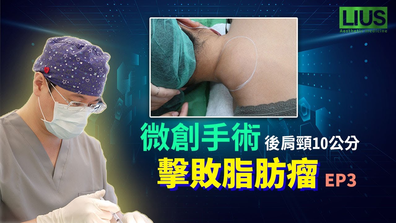 10公分後頸部脂肪瘤僅需3.5公分切口