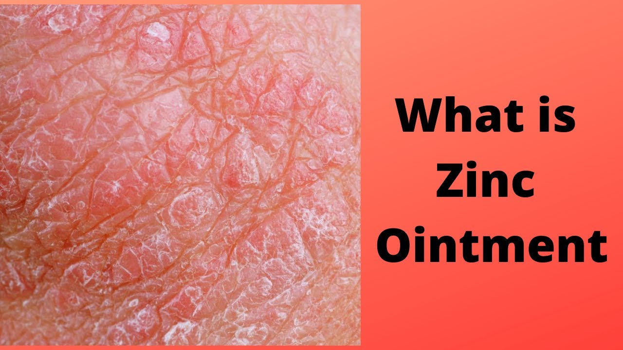 Watch video What is Zinc Ointment Now What is Zinc Ointment