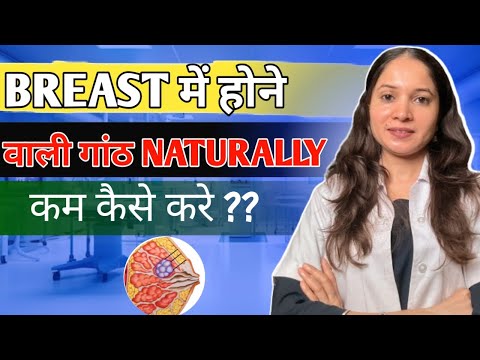 Breast मे होने वाली गांठ नैचुरली कम कैसे करे? Dr. Smita Bhoir Patil
