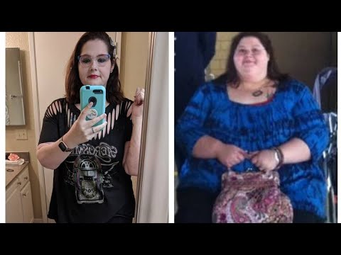 You Won't Believe My 7 month weigh-in!!! weight loss surgery revision distal bypass