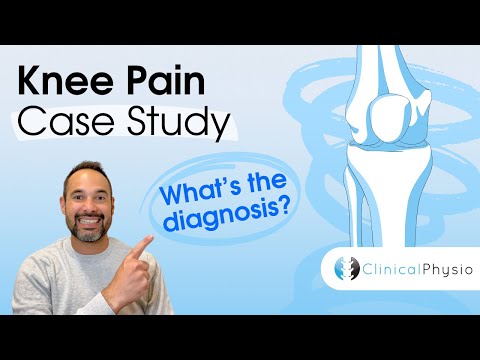 Anatomie & Behandlungswissen Videos – Interaktives Nachschlagewerk für Physio, Massage, Therapie 34 Knee Pain Case Study | Expert Physio Explains Vital Case and Clinical Reasoning!