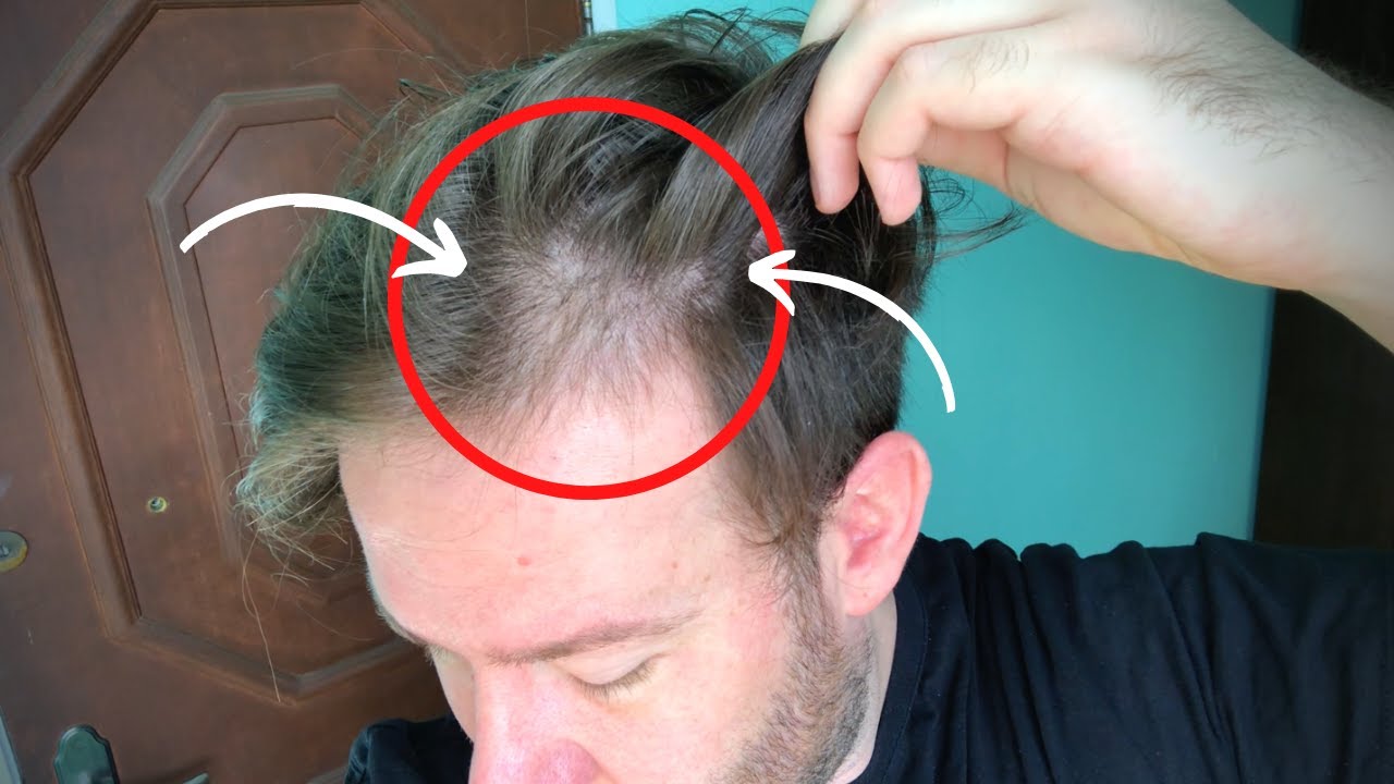 NÃO COMETA O MESMO ERRO QUE EU!