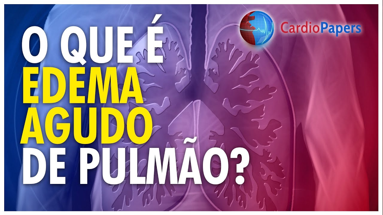 Aprender edema agudo de pulmão: entenda o que é
