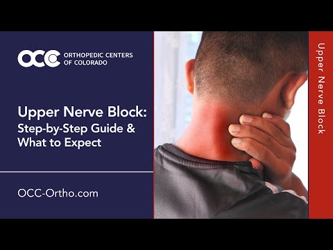 Upper Nerve Block: Step-by-Step Guide & What to Expect | OCC Perioperative Medicine