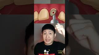 Download lagu GIGI COWOK INI HANCUR DIMAKAN ULAT | Yosua Andre #alurcerita #shortvideo #shorts mp3 Download lagu GIGI COWOK INI HANCUR DIMAKAN ULAT | Yosua Andre #alurcerita #shortvideo #shorts mp3