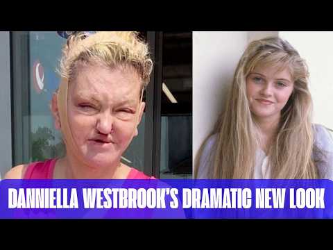 Danniella Westbrook Stuns Fans With Dramatic New Face After Surgery