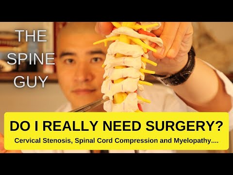 Spinal Cord Compression and central cervical stenosis. DO I REALLY NEED SURGERY?