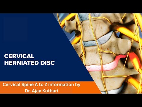 Cervical Spine A to Z information by Dr. Ajay Kothari