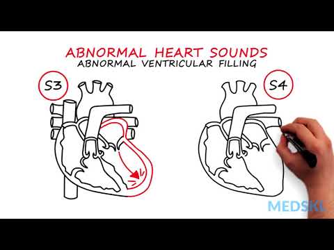 Abnormal Heartsounds and Murmurs: Which heart sounds should worry you