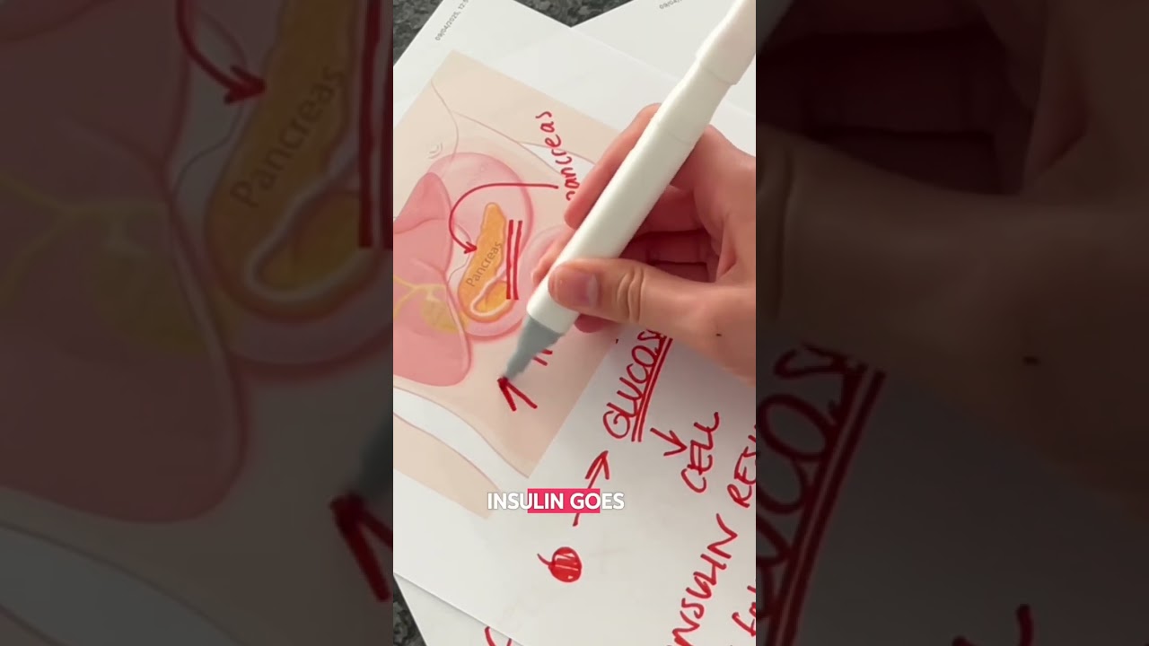 Insulin Resistance, Blood sugar & PCOS EXPLAINED