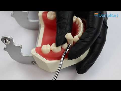 How to use Luxators | Waldent