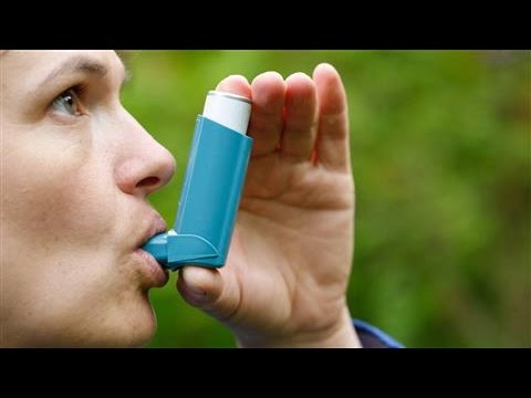 Beclometasone (200mcg/spray) beclate 200 inhaler
