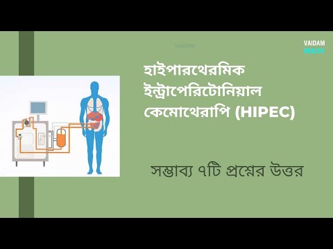 HIPEC- ৭ টি প্রায়শই জিজ্ঞাসিত প্রশ্ন
