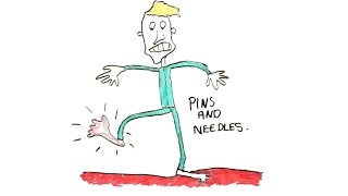 What are Pins & Needles?