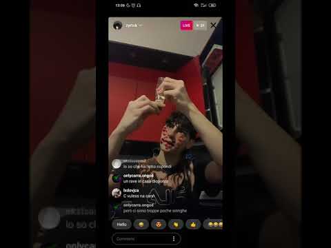 LIVE MATTUTINA DI ZYRTCK