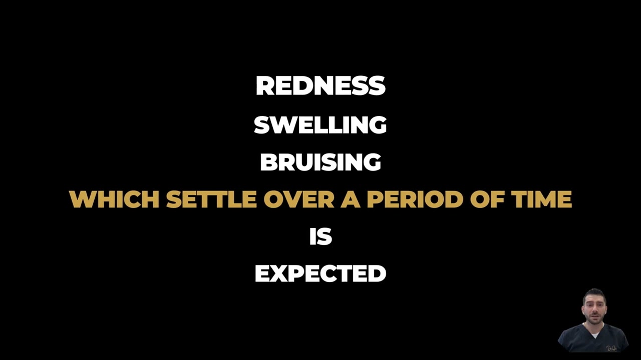 The Ultimate Guide: What to Expect After Dermal Fillers - Your Post-Treatment Experience